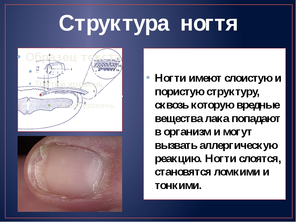 Изменение структуры ногтей на руках фото и описание