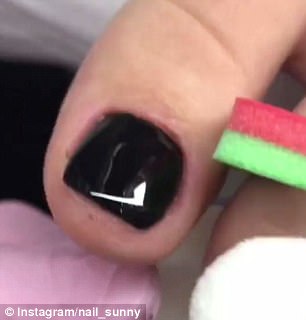 Addictive: The nail technician worked true magic with the broken and fungus-infected toenails using a variety of tools