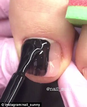 Addictive: The nail technician worked true magic with the broken and fungus-infected toenails using a variety of tools