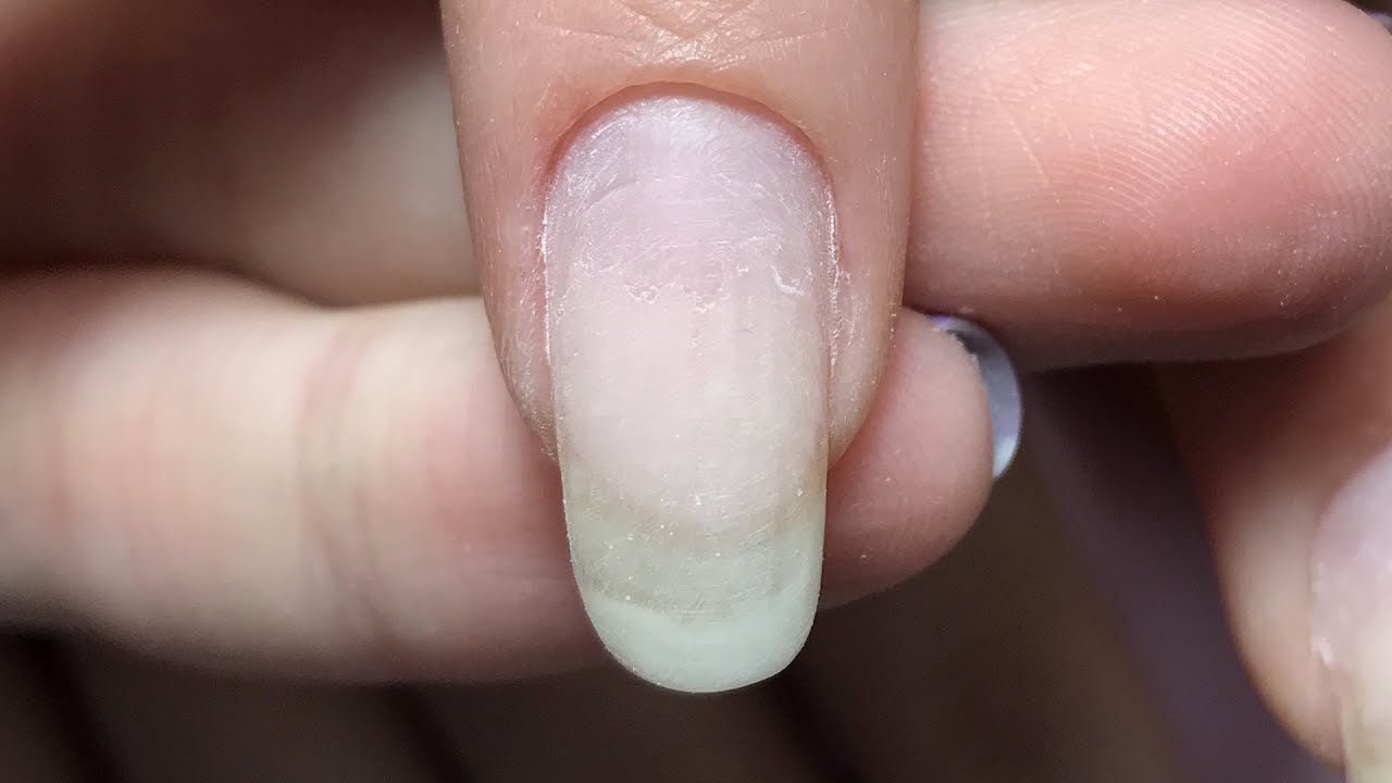 Маникюр трещины. Трещины на ногтях после гель лака.