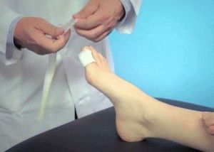 Повязка на палец ноги
