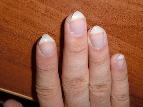 Почему ногти стали тоньше. Тонкие ногти. Трапециевидная форма ногтей. Широкие ногти. Трапециевидные ногти на руках.