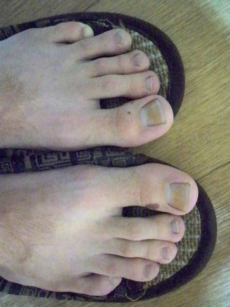 Ногти на ногах коричневого цвета фото и названия