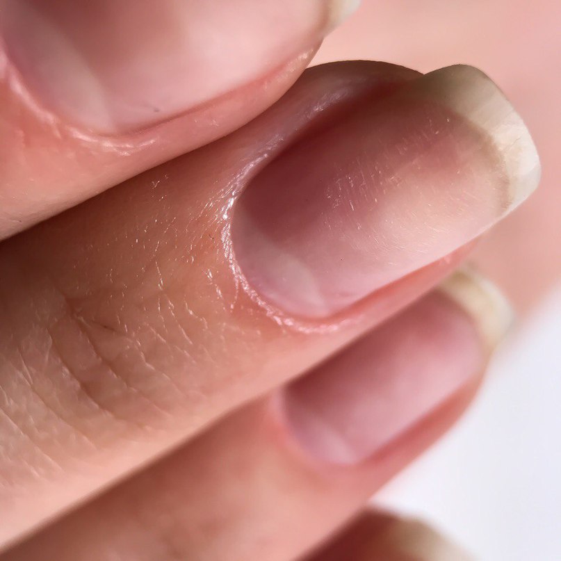 Ногти тонкие мягкие что делать. Большие ногтевые пластины.