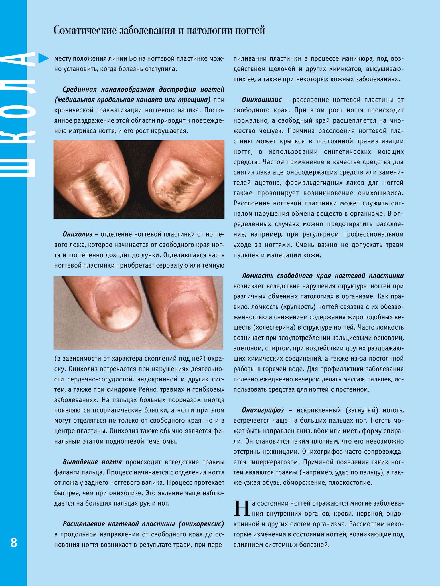 О чем говорит заболевание ногтей. Определить болезнь по ногтям.
