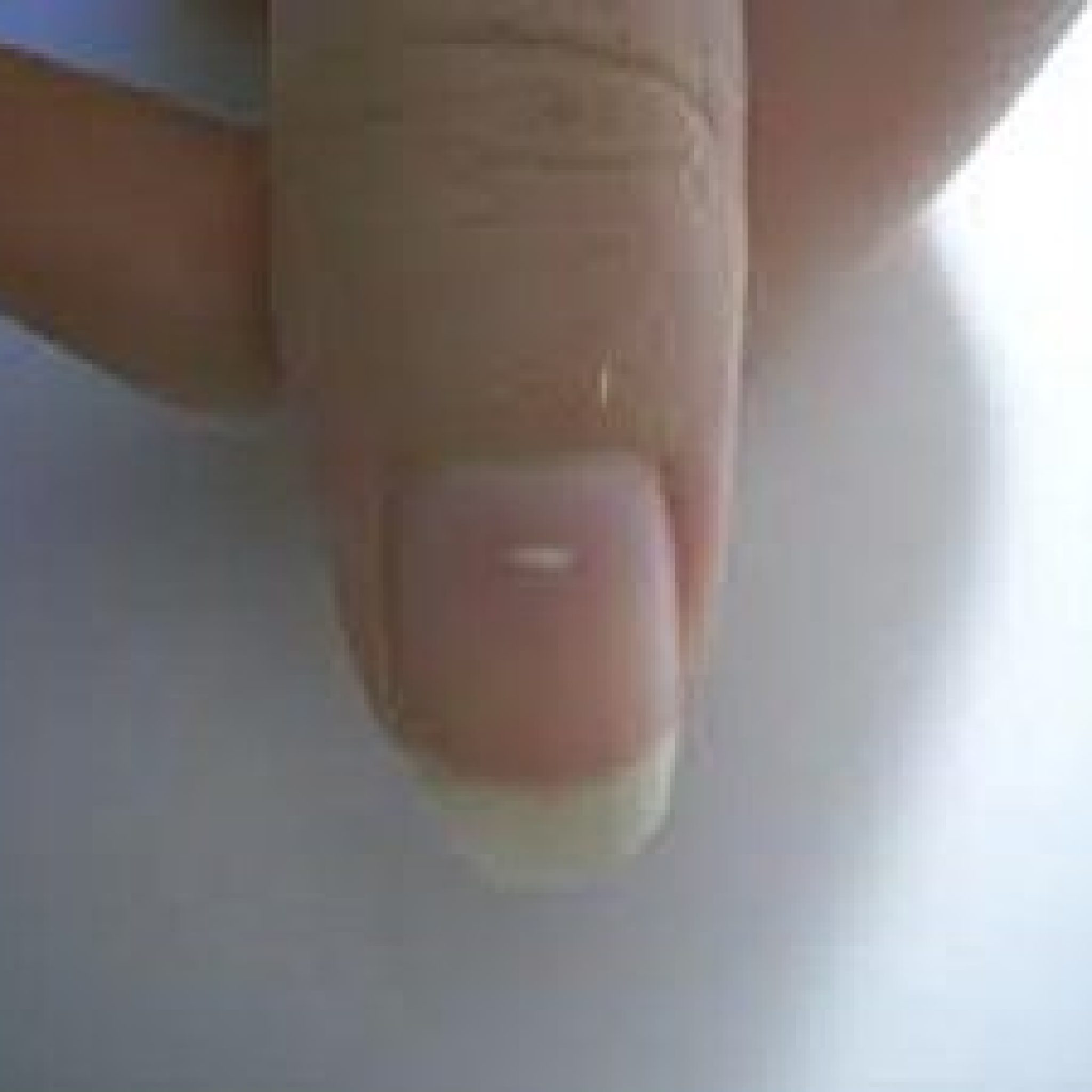 Что означают белые пятна на ногтях рук. Лейконихия (белые пятнышки).
