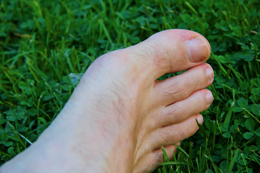 signs of toenail fungus healing