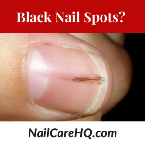 Black Nail Spots?