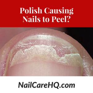 Is polish causing my nails to peel? 
