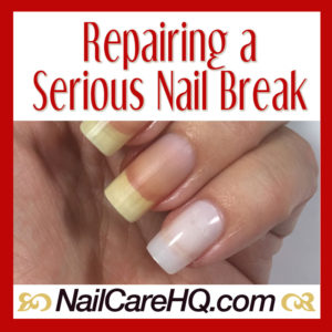 Broken Nail Repair: Repairing a Serious Nail Break