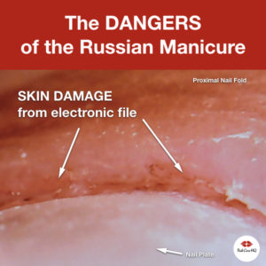 Russian Manicure Damage Microscopic Photos