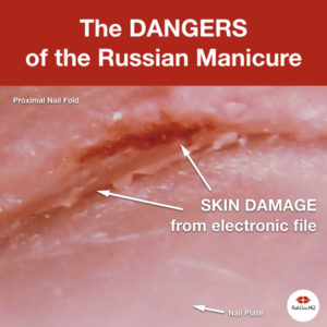 Russian Manicure Damage Microscopic Photos.006